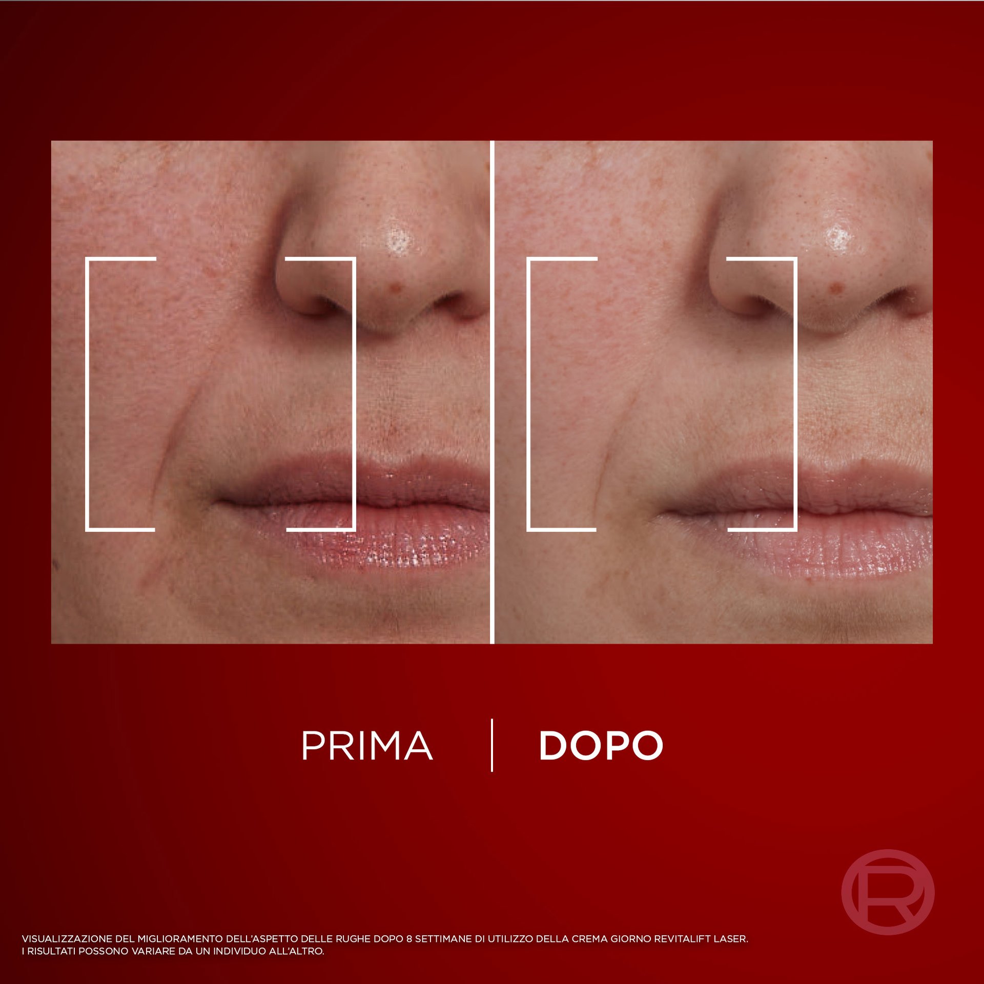 230145   SKINCARE   LASER   Banner Pdp Sito 720x720px V1 F1 2 1
